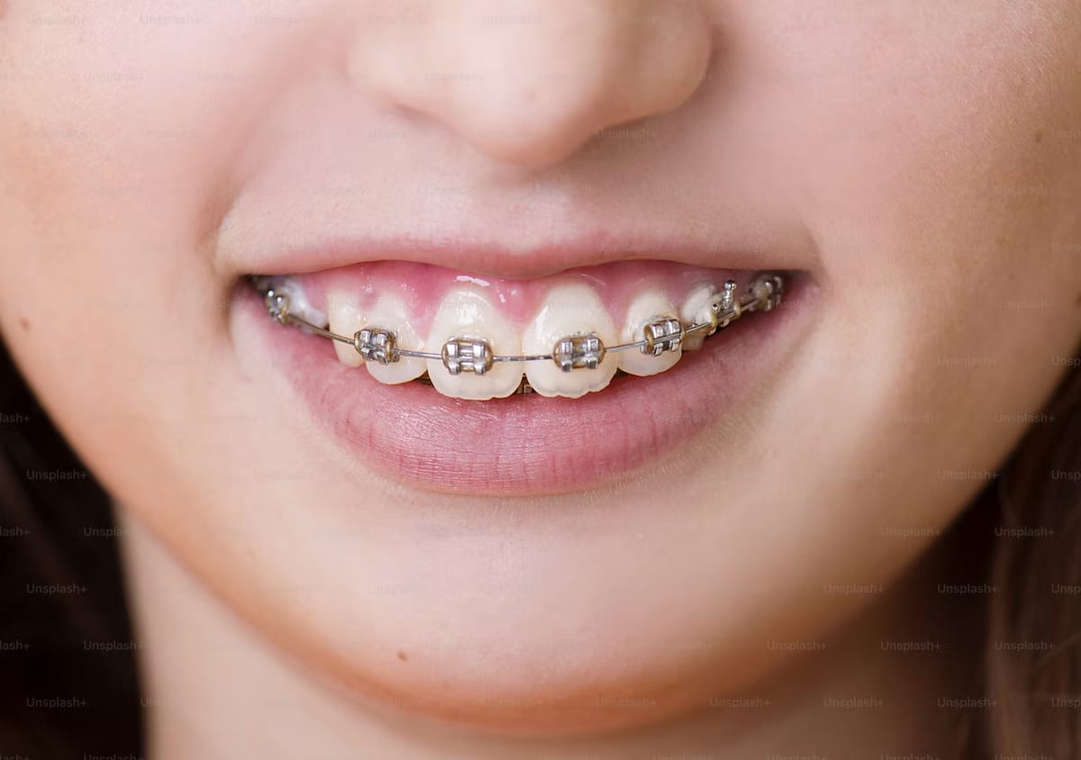 Orthodontic braces treatment at Brothers Dental
