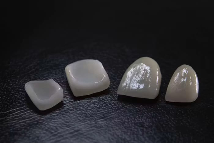 Dental crown and bridge model comparison
