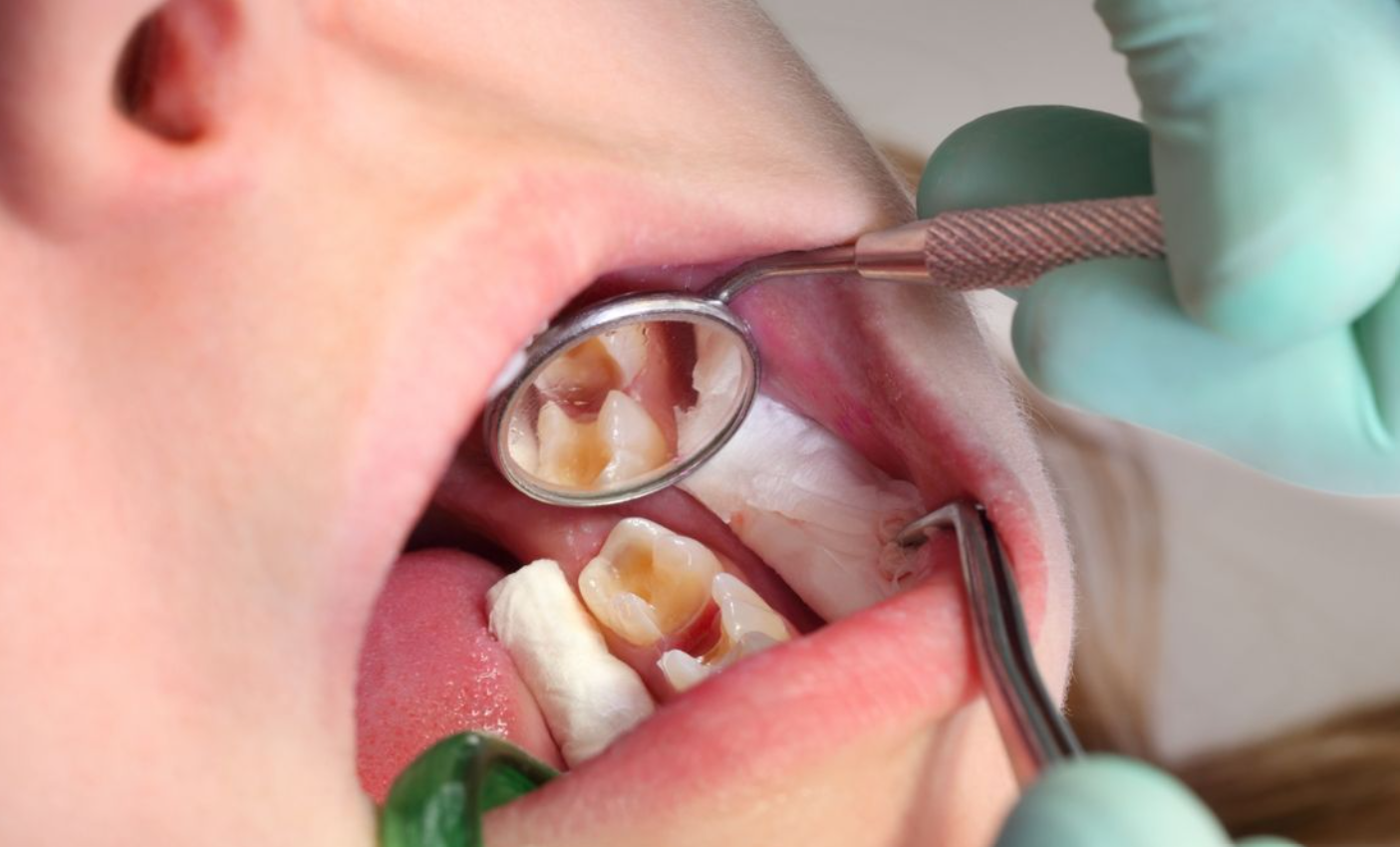 Children's dentistry at Brothers Dental