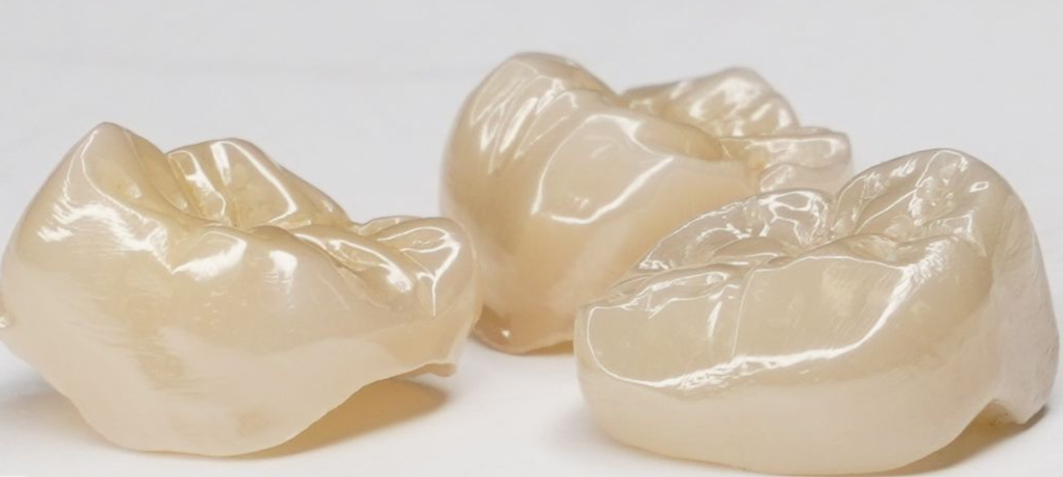 Dental Crown at Brothers Dental, Brahmanbaria
