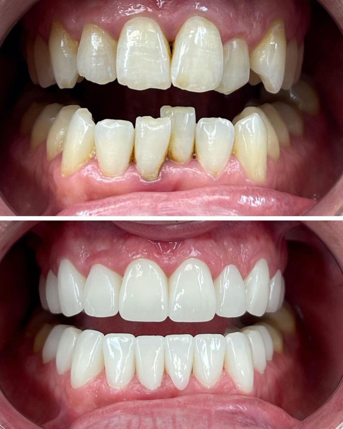 Smile & Cosmetic dentistry at Brothers Dental