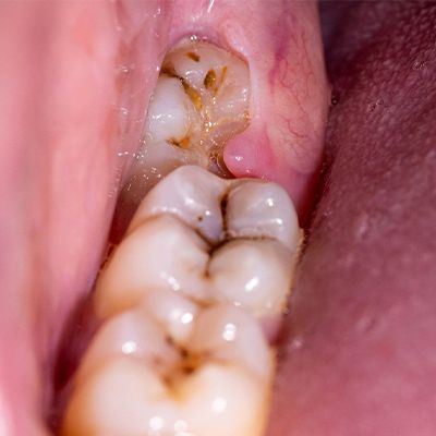 Surgery at Brothers Dental